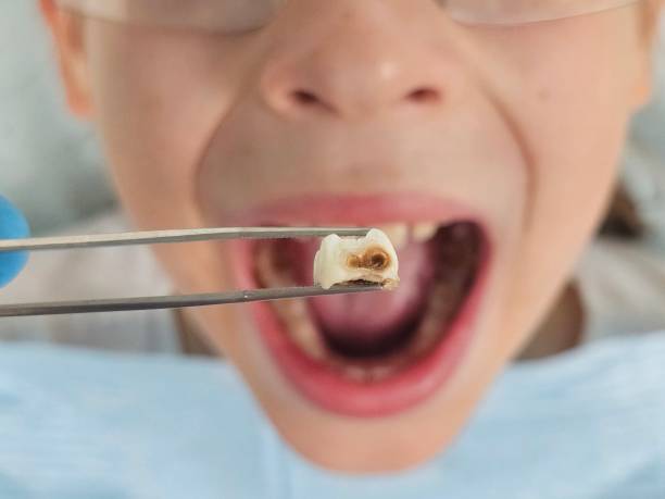 Best Pediatric Emergency Dentist in Mked Tree, AR